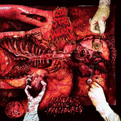 Manual Manic Procedures - Vinile LP di 200 Stab Wounds