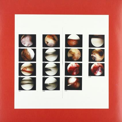 Laughing In My Sleep -Download- - Vinile LP di Cradle