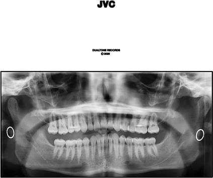 Jvc - Vinile LP di Jack Van Cleaf