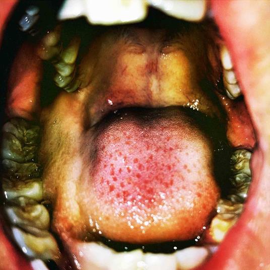 Public Storage - Vinile LP di Hana Vu