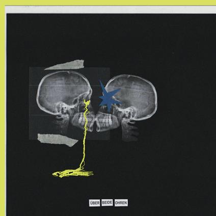 Uber Beide Ohren (Yellow Vinyl) - Vinile LP di Nikra