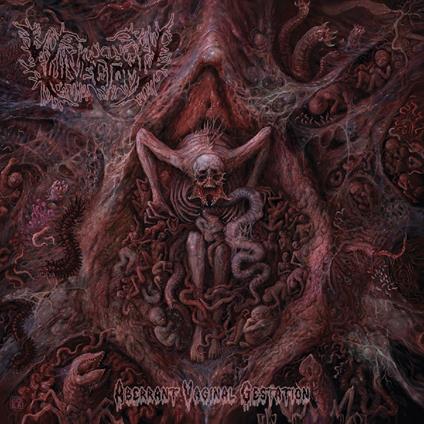 Aberrant Vaginal Gestation - CD Audio di Vulvectomy