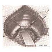 Hollywound - Vinile LP di Dark Union