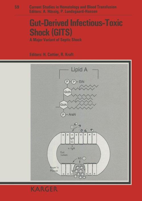 Gut-Derived Infectious-Toxic Shock - copertina