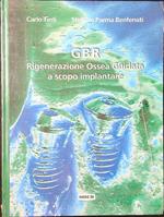 GBR Rigenerazione Ossea Guidata a scopo implantare