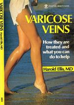 Varicose Veins. How They Are Treated And What You Can Do To Help