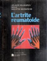 L' artrite Reumatoide