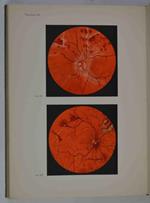 Fundus oculi. Diagnostica oftalmoscopica