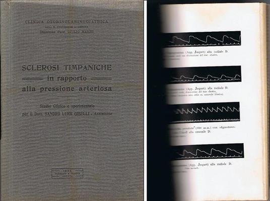 Sclerosi timpaniche in rapporto alla pressione arteriosa. Studio clinico e sperimentale - copertina