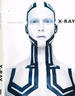 X-ray