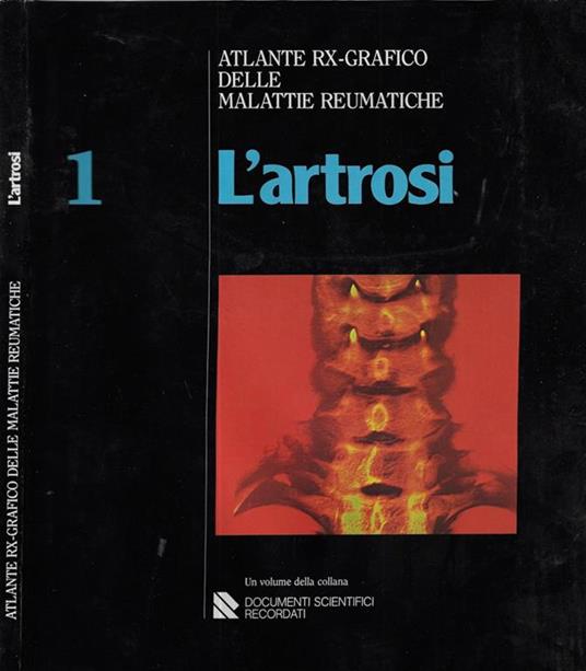 L' artrosi Vol I. Atlante rx-grafico delle malattie reumatiche - I. Caruso - copertina