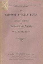 La crioscopia delle urine e del liquido ascitico nelle malattie di fegato