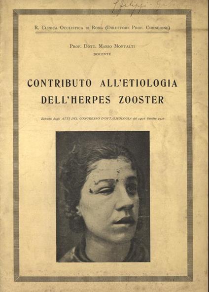 Contributo all' etiologia dell' herpes zooster - copertina