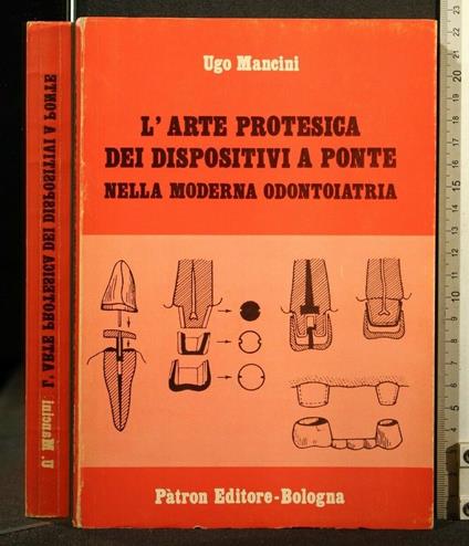 L' Arte Protesica Dei Dispositivi a Ponte Nella Moderna - Arte Protesica Dei Dispositivi a Ponte Nella Moderna di: Ugo Mancini - copertina
