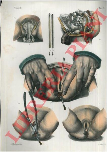 Operazioni sopra il retto - copertina