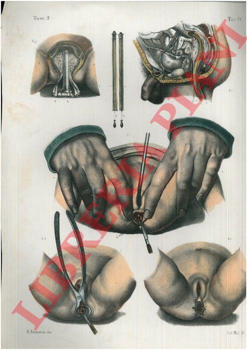 Operazioni sopra il retto - copertina