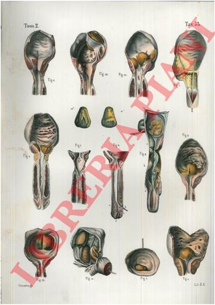 Malattie dell'uretra, della prostata, della vescica - copertina