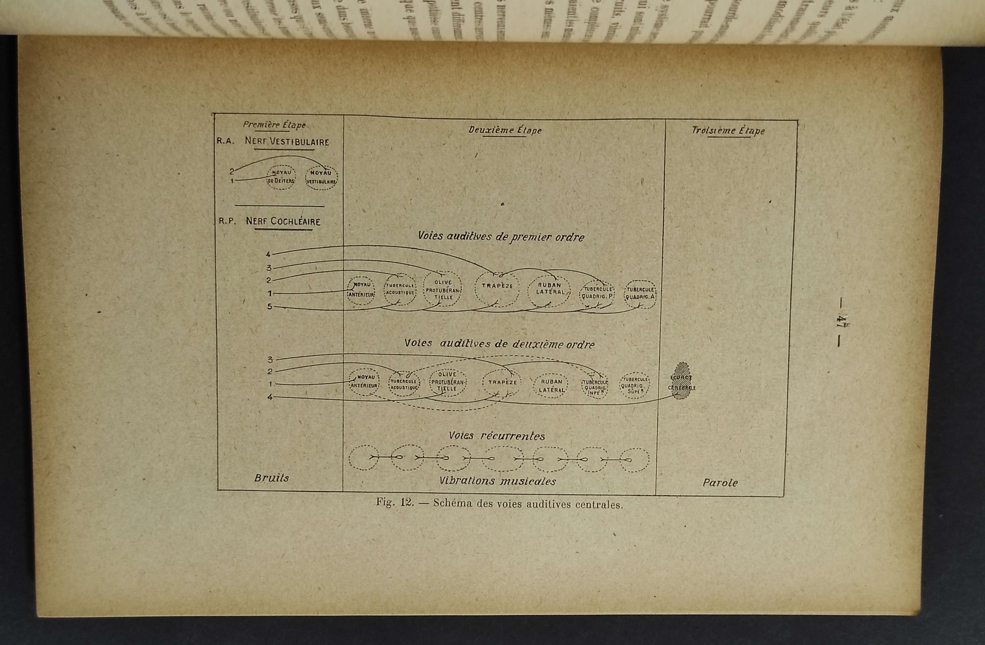 L' Audition et Ses Variantions - Marage -Ed. Gauthier-Villars