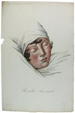 Tavola originale: ROSOLIA ANORMALE., N. 11 (da: CLINICA DEL PARIGINO SPEDALE DI S.LUIGI OSSIA TRATTATO COMPIUTO DELLA PELLE ...)