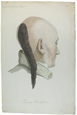 Tavola originale: TRICOMA CAUDIFORME, N. 22 (da: CLINICA DEL PARIGINO SPEDALE DI S.LUIGI OSSIA TRATTATO COMPIUTO DELLA PELLE ...)