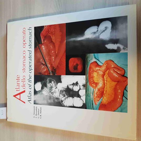 ATLANTE DELLO STOMACO OPERATO - SIMONETTI, BRESADOLA, DETTORI 1988 atlas of the - copertina