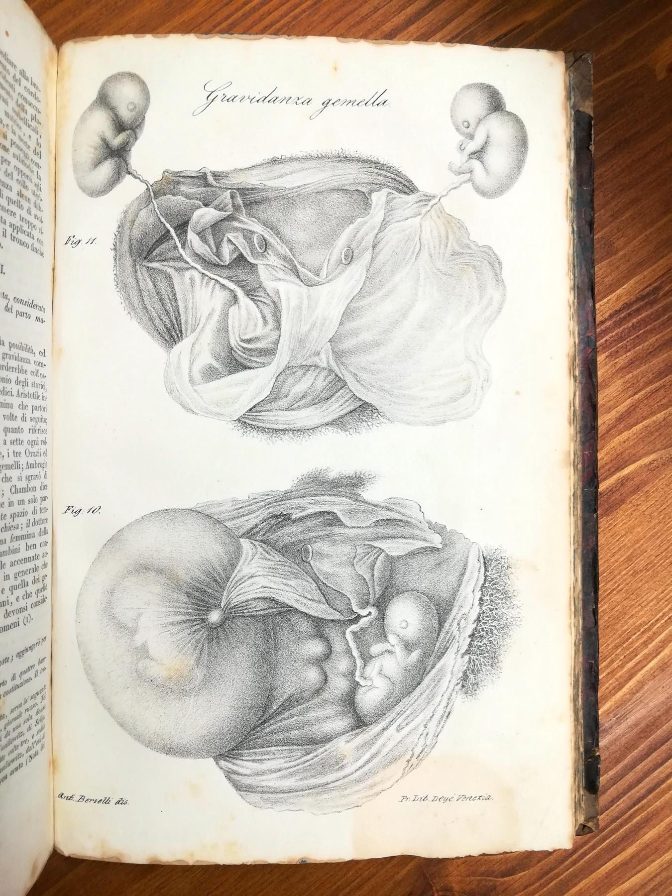 Corso teorico e pratico di Otetricia nel quale si espongono i principi di questo ramo dell'arte sanatrice, le cure richieste dalla donna durante e dopo il parto