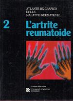 L' artrite Reumatoide 2