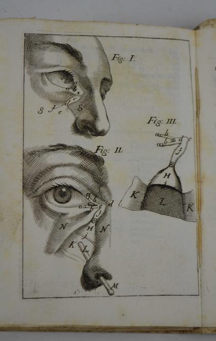 Delle Fistole Lacrimali il pro, e contra nel nuovo Metodo di guarirle proposto dal sig. Domenico Anel francese ed impugnato dal sig. Francesco Signorotti in Genova. Con Riflessioni Chirurgiche, ed Ana - Sebastiano Martelli - copertina