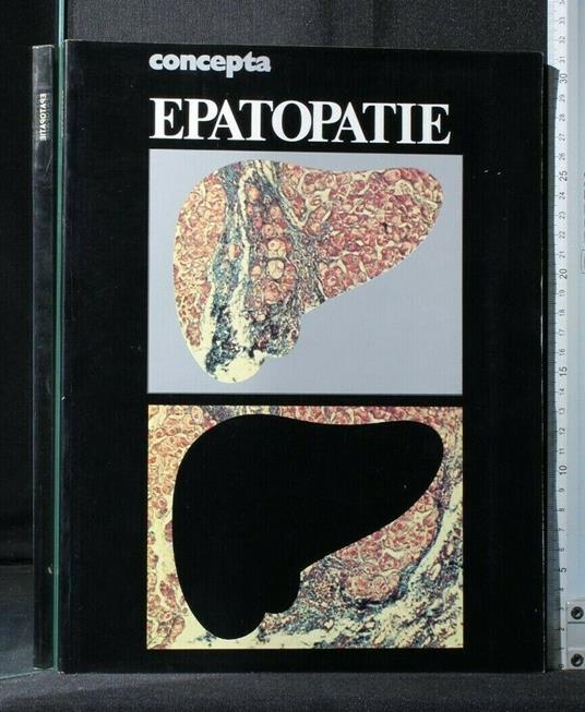 Concepta Epatopatie - copertina