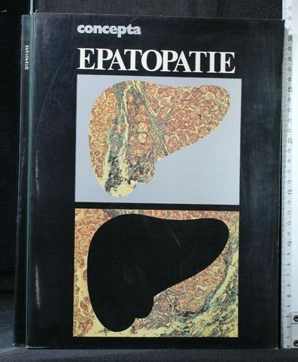 Concepta Epatopatie - copertina