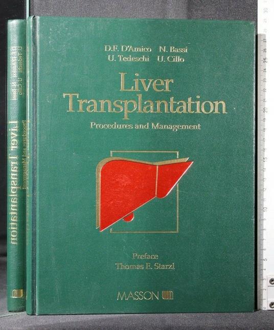 Liver Transplantation Procedures And Management - copertina