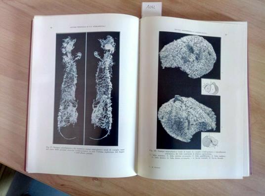 Le Varici Esofagee Nel Bambino E Nell'Adulto Domini 1965 Piccin Morfogenesi 100 - Remigio Domini - copertina