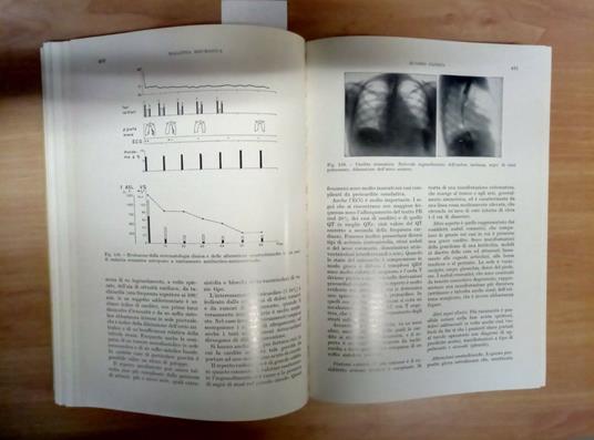 Manuale Di Pediatria Schwarz Tiene 1978 Ambrosiana - 253 - E. Schwarz Thiene - copertina