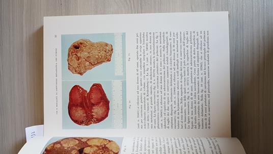 Corso Superiore Sulla Diagnosi E Terapia Delle Metastasi - copertina