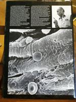 Atlante Grafico Della Arteriosclerosi Volume 2 - Skema - Alfa Farmaceutici