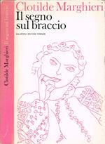 Il segno sul braccio