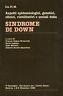 Sindrome di Down