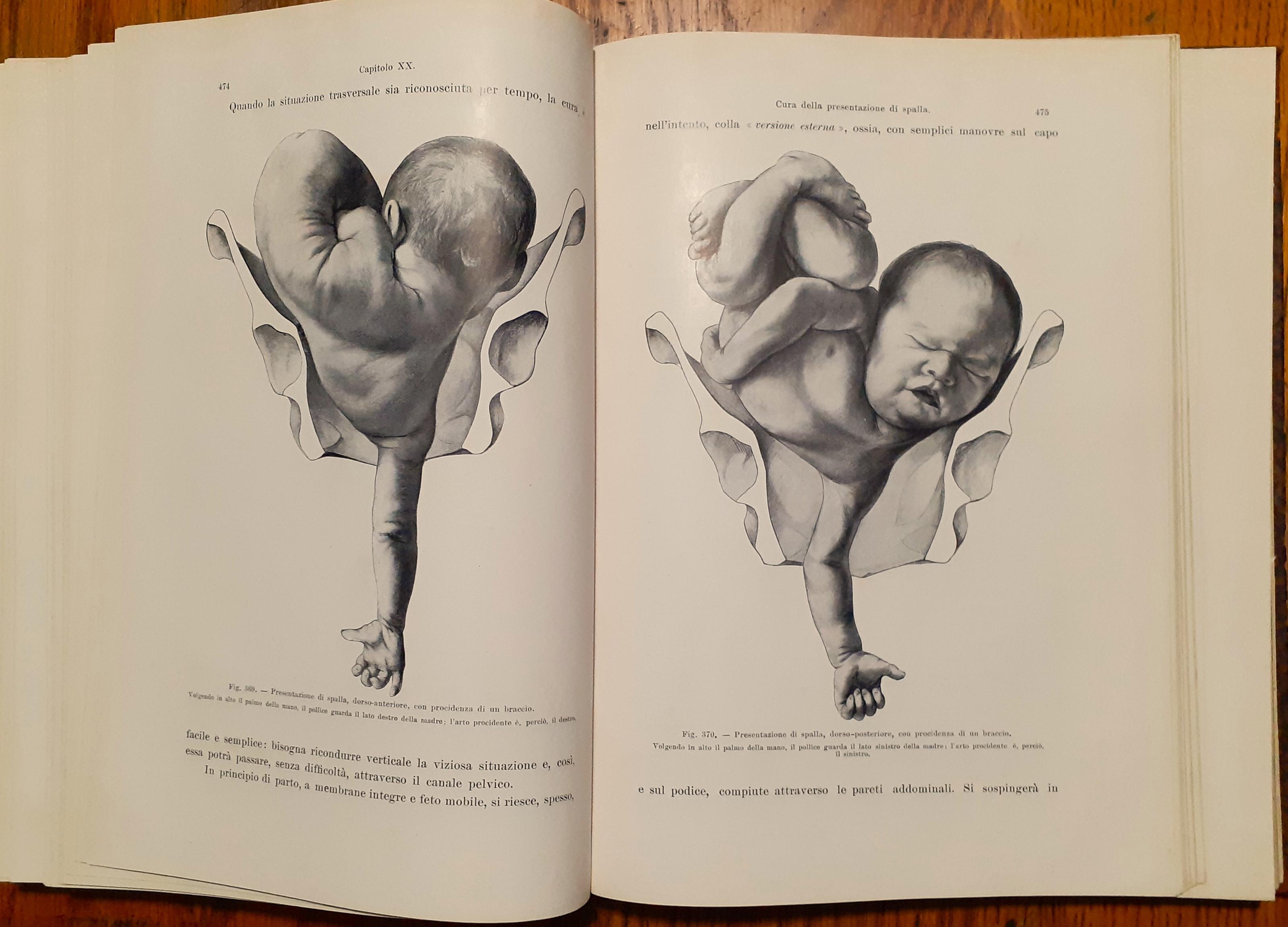 Trattato completo di ostetricia ad uso degli studenti e dei medici pratici