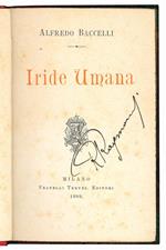 Iride umana