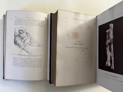 Lecons sur les maladies du systeme nerveux faites a la Salpetriere. Tome I-II - copertina