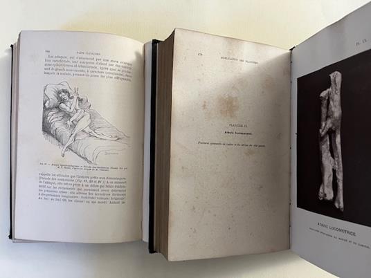 Lecons sur les maladies du systeme nerveux faites a la Salpetriere. Tome I-II - copertina