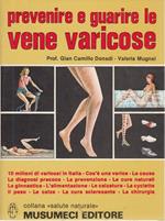 Prevenire e guarire le vene varicose