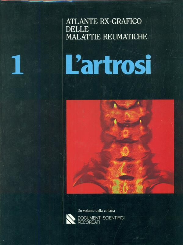 Atlante rx-grafico delle malattie reumatiche. L' artrosi