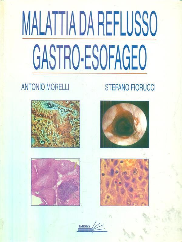 Malattia da reflusso gastro-esofageo