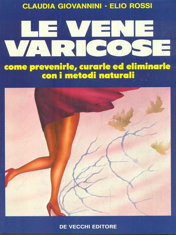 Le vene varicose