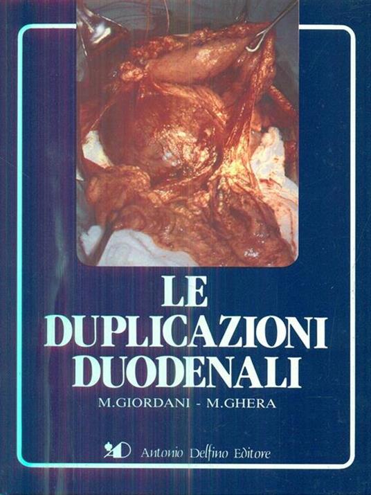Le duplicazioni duodenali - Igino Giordani - copertina