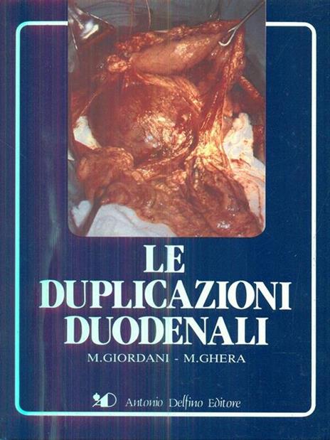 Le duplicazioni duodenali - Igino Giordani - copertina