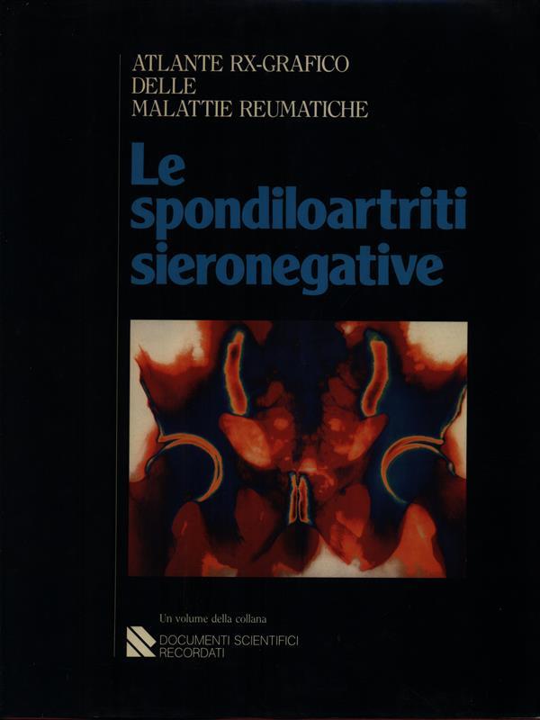 Le spondiloartriti sieronegative