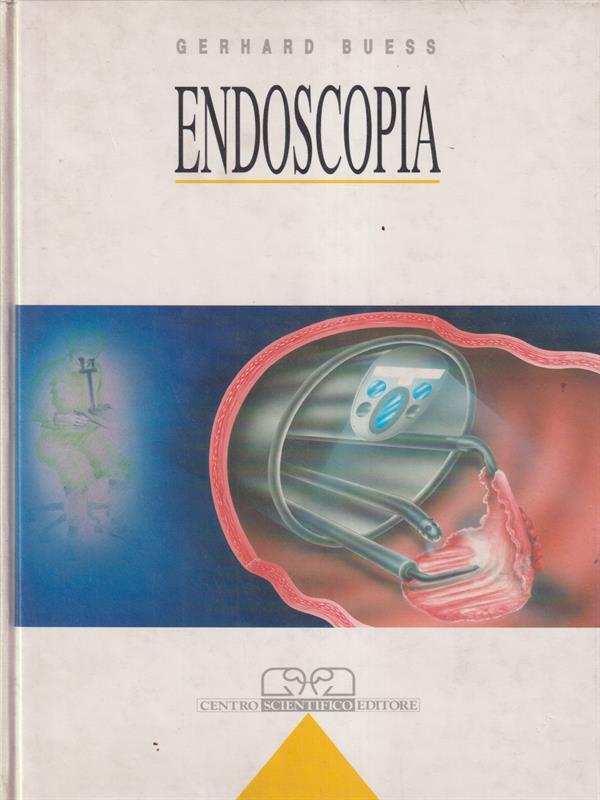Endoscopia Buess