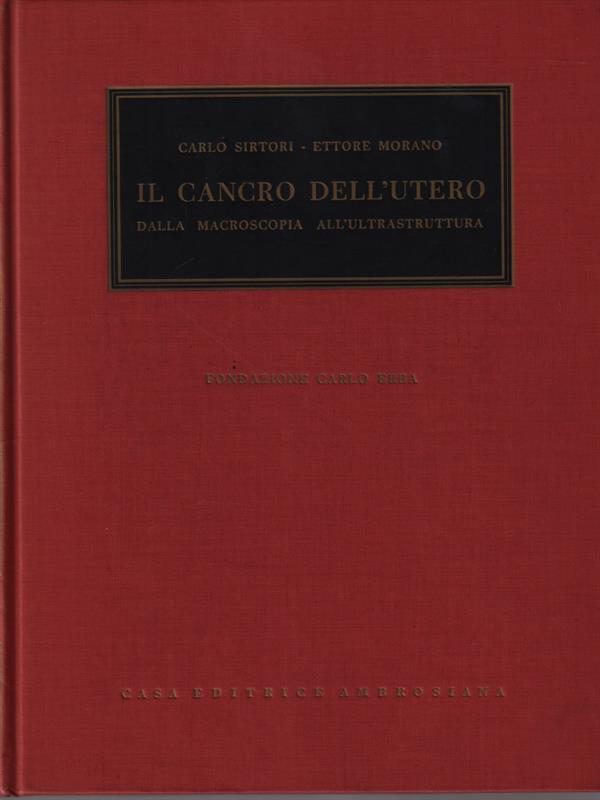 Il cancro dell'utero